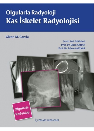 OLGULARLA RADYOLOJİ KAS İSKELET RADYOLOJİSİ