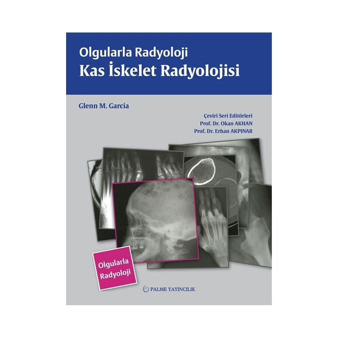 OLGULARLA RADYOLOJİ KAS İSKELET RADYOLOJİSİ