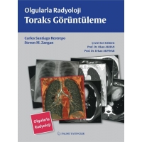 OLGULARLA RADYOLOJİ TORAKS GÖRÜNTÜLEME