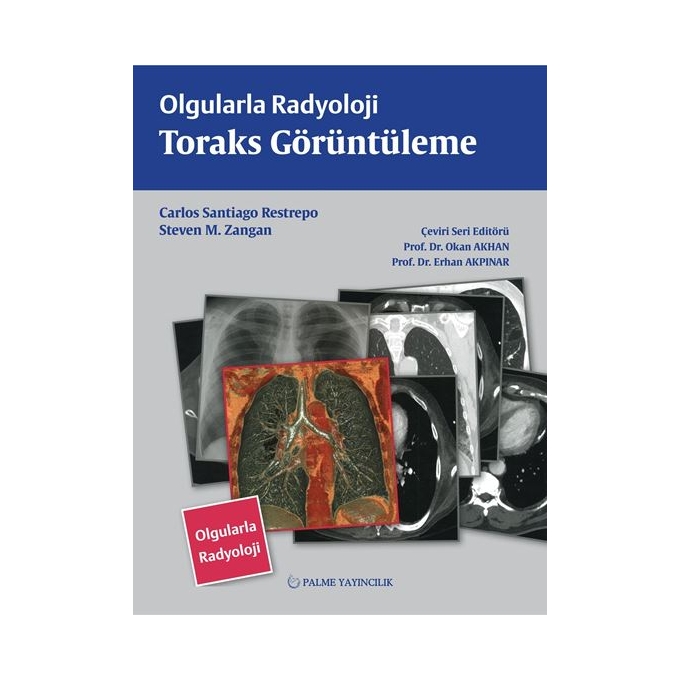 OLGULARLA RADYOLOJİ TORAKS GÖRÜNTÜLEME