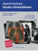 OLGULARLA RADYOLOJİ TORAKS GÖRÜNTÜLEME