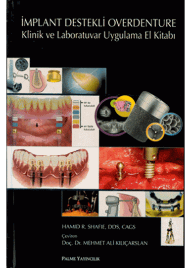 İmplant Destekli Overdenture Klinik ve Laboratuvar Uygulama El Kitabı