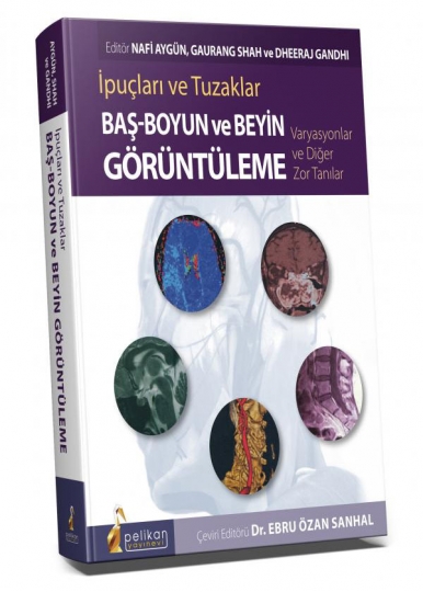 İpuçları ve Tuzaklar Baş - Boyun ve Beyin Görüntüleme Varyasyonlar ve Diğer Zor Tanılar