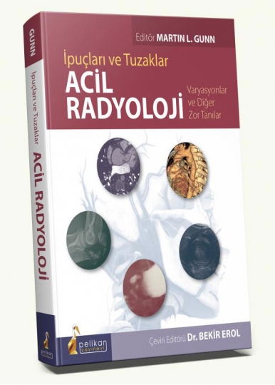 İpuçları ve Tuzaklar Acil Radyoloji