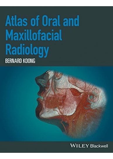 Atlas of Oral and Maxillofacial Radiology