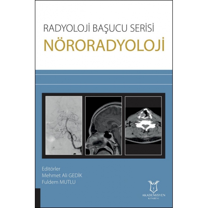 Radyoloji Başucu Serisi - Nöroradyoloji