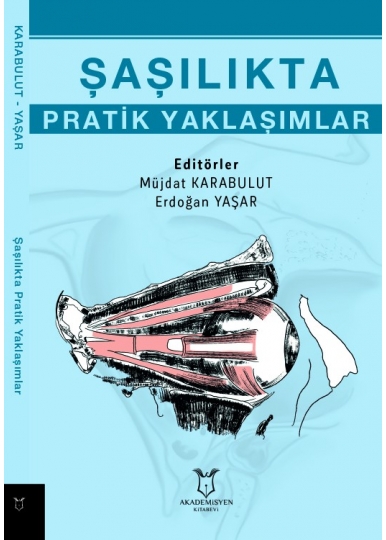 Şaşılıkta Pratik Yaklaşımlar