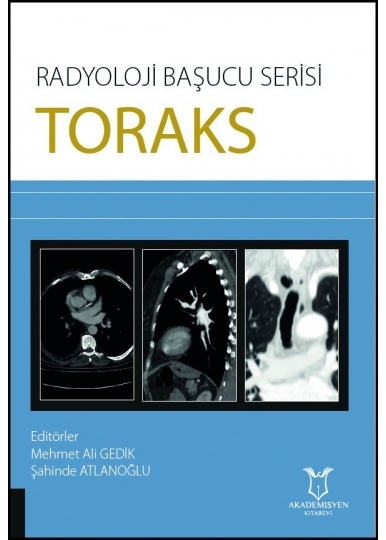 Radyoloji Başucu Serisi Toraks