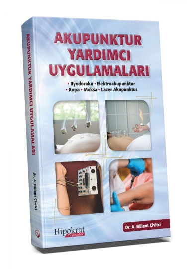 Akupunktur Yardımcı Uygulamaları