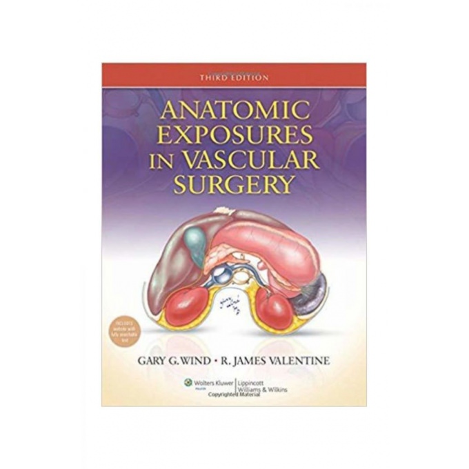Anatomic Exposures in Vascular Surgery