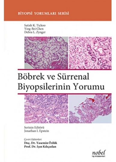 Böbrek ve Sürrenal Biyopsilerinin Yorumu - Biyopsi Yorumları Serisi