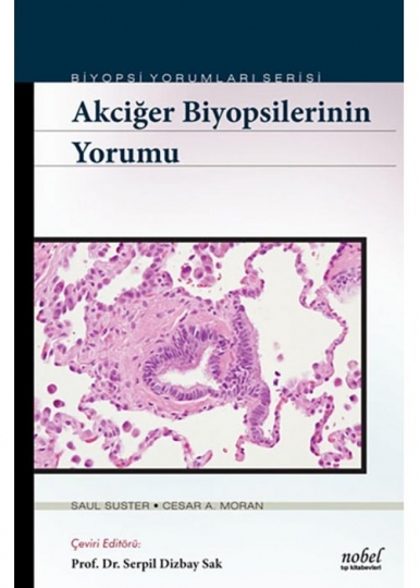 Akciğer Biyopsilerinin Yorumu Biyopsi Yorumları Serisi