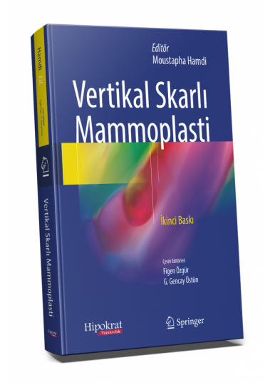 Vertikal Skarlı Mammoplasti