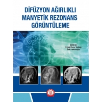 Difüzyon Ağırlıklı Manyetik Rezonans Görüntüleme
