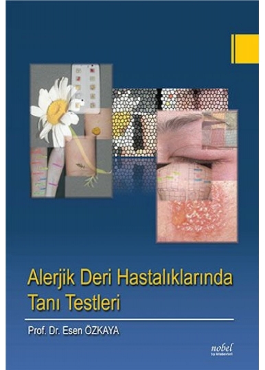 Alerjik Deri Hastalıklarında Tanı Testleri
