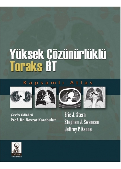 Yüksek Çözünürlüklü Toraks BT
