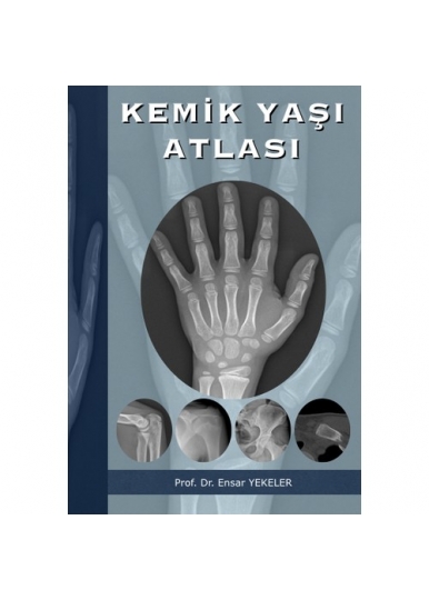 Kemik Yaşı Atlası