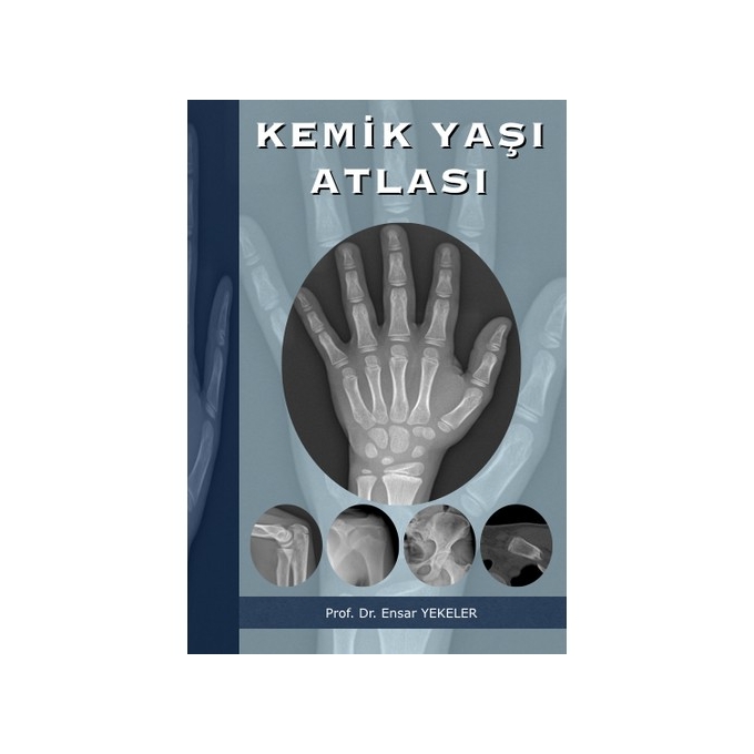 Kemik Yaşı Atlası