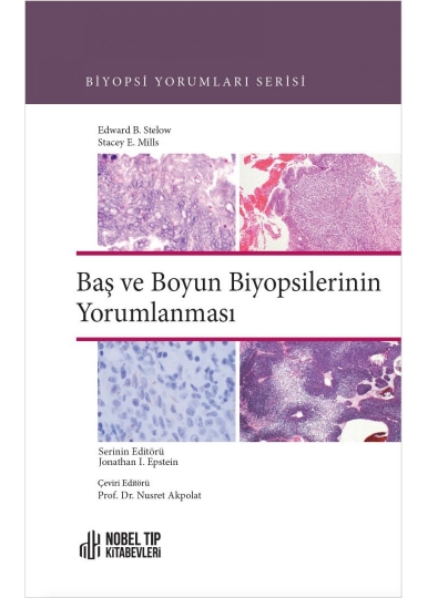 Baş ve Boyun Biyopsilerinin Yorumlanması