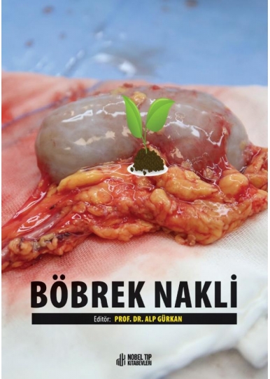 Böbrek Nakli
