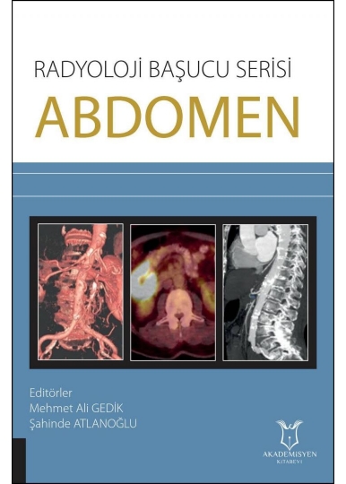 Radyoloji Başucu Serisi - Abdomen
