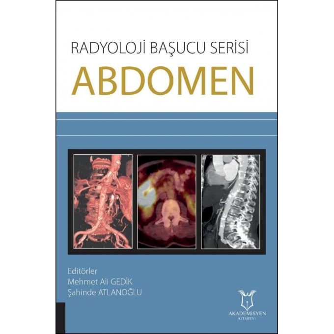 Radyoloji Başucu Serisi - Abdomen