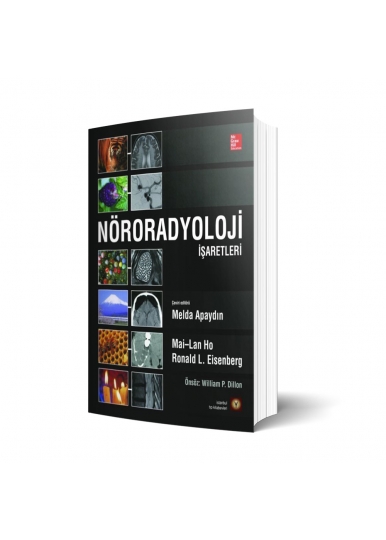 Nöroradyoloji İşaretleri