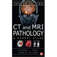 CT & MRI Pathology: A Pocket Atlas
