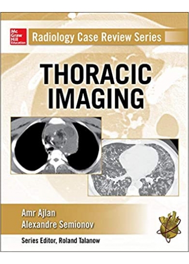 Radiology Case Review Series: Thoracic Imaging