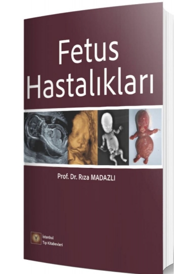 Fetus Hastalıkları