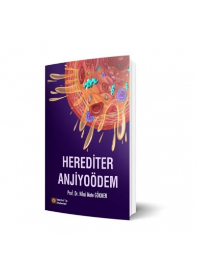 Herediter Anjiyoödem