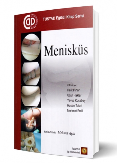 Menisküs
