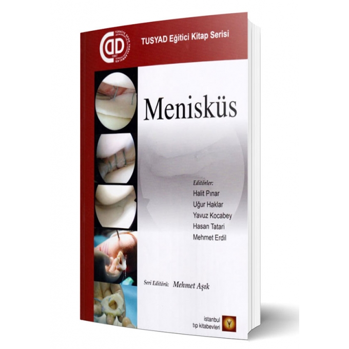 Menisküs