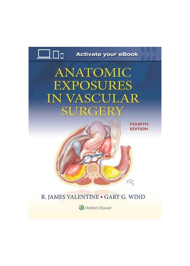  Anatomic Exposures in Vascular Surgery