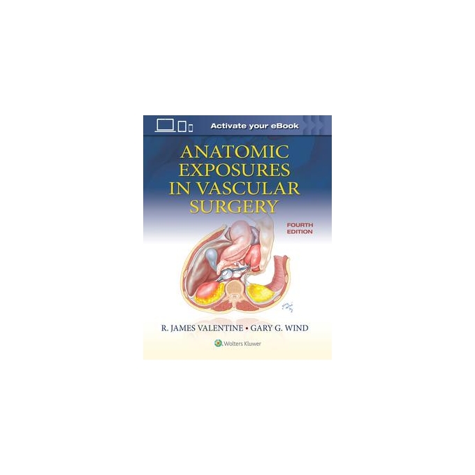 Anatomic Exposures in Vascular Surgery