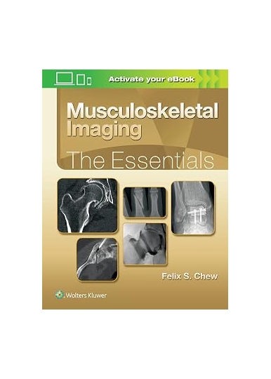 Musculoskeletal Imaging: The Essentials (Essentials Series)