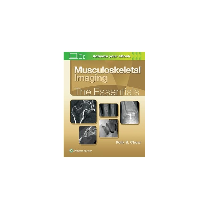 Musculoskeletal Imaging: The Essentials (Essentials Series)