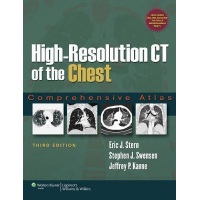 High-Resolution CT of the Chest: Comprehensive Atlas