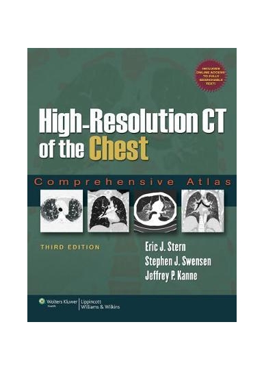 High-Resolution CT of the Chest: Comprehensive Atlas