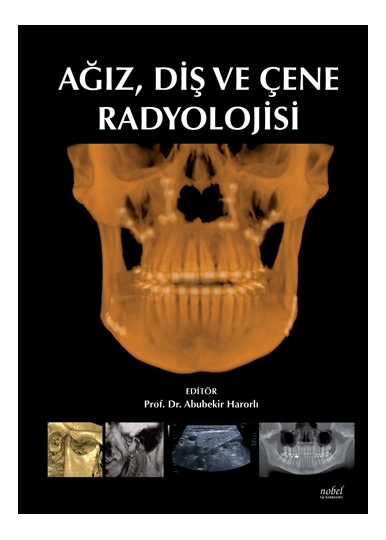 Ağız, Diş ve Çene Radyolojisi