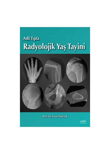 Adli Tıpta Radyolojik Yaş Tayini