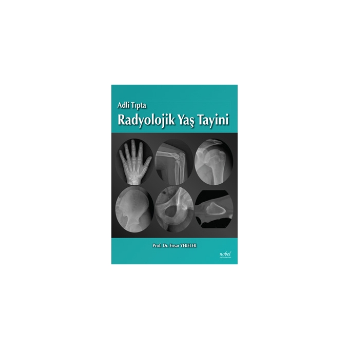 Adli Tıpta Radyolojik Yaş Tayini