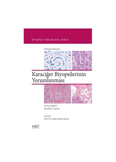 Karaciğer Biyopsilerinin Yorumlanması Biyopsi Yorumları Serisi