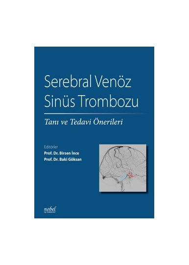 Serebral Venöz Sinüs Trombozu: Tanı ve Tedavi Önerileri
