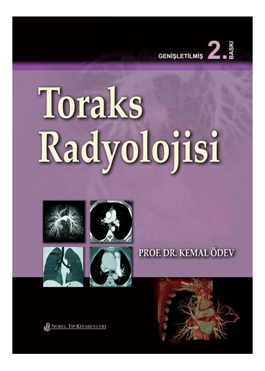Toraks Radyolojisi