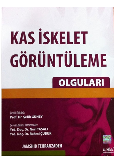 Kas İskelet Görüntüleme Olguları