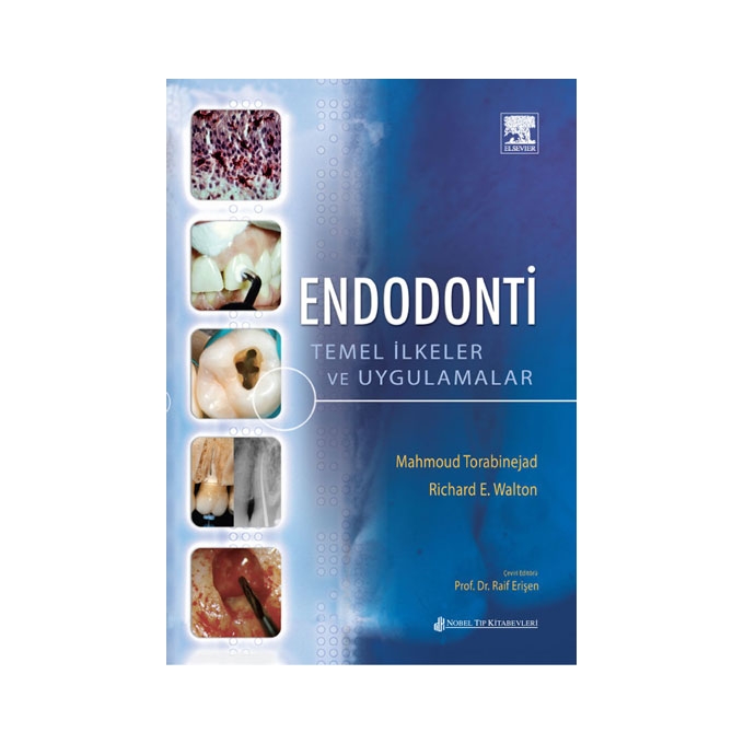 Endodonti Temel İlkeler ve Uygulamalar