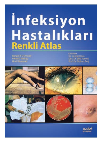 İnfeksiyon Hastalıkları: Renkli Atlas