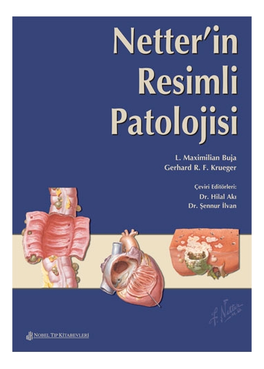 Netter'in Resimli Patolojisi