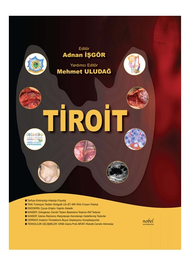 Tiroit